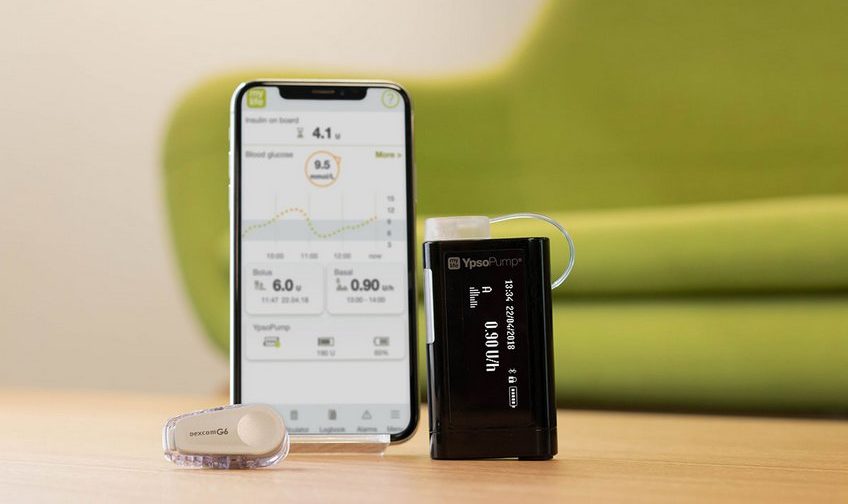 Mylife YpsoPump čeká propojení se senzorem Dexcom G6