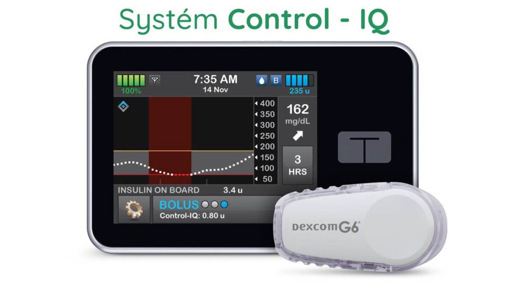 Tandem: Nový systém uzavřené smyčky Control-IQ