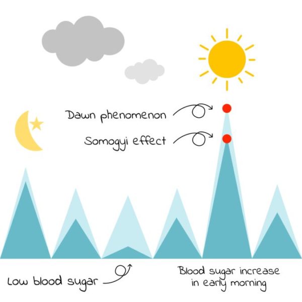 Když cukrovka hraje proti vám: Somogyiho efekt a brittle diabetes